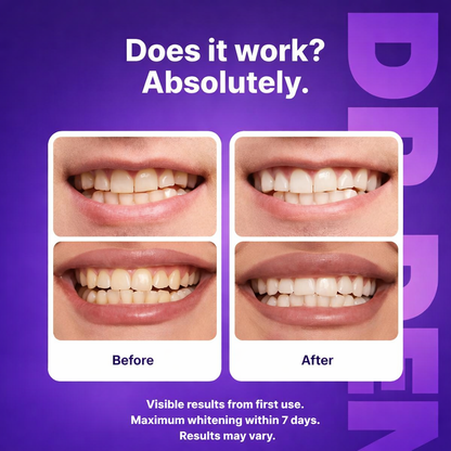 VioSmile® Purple Whitening Strips