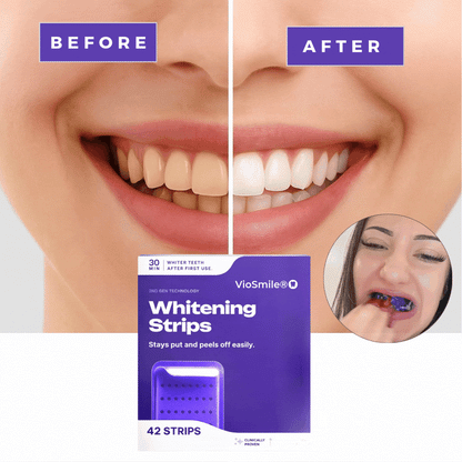VioSmile® Purple Whitening Strips